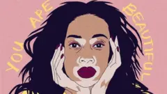 برص