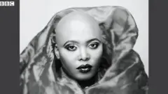 alopecie