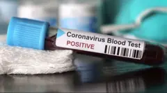 ਕੋਰੋਨਾਵਾਇਰਸ
