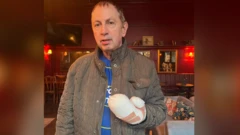 Stephen olha para a câmera, levantando a mão esquerda enfaixada. Ela está totalmente coberta por bandagens e curativos. Ele veste uma camisa azul de futebol sob uma jaqueta acolchoada cinza. Ele está em pé no que parece ser um restaurante-bar.