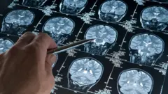 Una mano apuntando a una resonancia magnética cerebral de la cabeza y el cráneo.