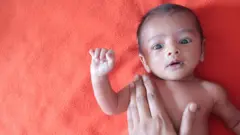 मुंबईसारख्या आंतरराष्ट्रीय शहरातील उपनगरात कुपोषित बालकांची संख्या सर्वाधिक आहे.