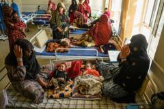 یونیسف: په افغانستان کې یو میلیون ماشومان له ژوند ګواښونکې خوارځواکۍ سره مخ دي