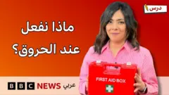 |كيف نعالج الحروق؟ وما هو الإحصاء؟|