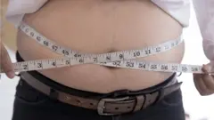 腰圍