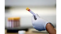 أعداد غير مسبوقة للاصابات بكورونا في العراق والأردن وتونس والمغرب ومخاوف من موجة ثانية في كامل المنطقة العربية