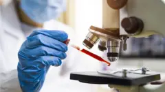 HIV: या बाईंनी एड्सवर कशी मात केली?