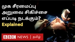அன்னப்பிளவு உள்ளிட்ட பாதிப்புகள் உள்ளவர்களுக்கு முக சீரமைப்பு அறுவை சிகிச்சை எவ்வாறு செய்யப்படும், பின்விளைவுகள் என்ன என்று விளக்குகிறார் மருத்துவ நிபுணர்.