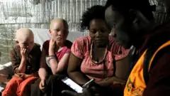 የኬንያ አልቢኖ ማህበረሰብ