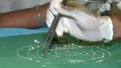 பற்கள்