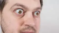 XANUUNKA INDHAHA BANAANKA U SOO SARA
