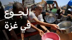 الجوع في غزة