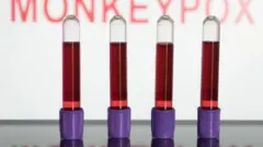 የላብራቶሪ የደም ናሙና 