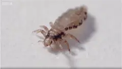 उवा