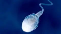 Doctors say that ejaculating during sleep is a completely normal and healthy phenomenon. නින්දේදී ශුක්‍රාණු පිටවීම සම්පූර්ණයෙන්ම සාමාන්‍ය සහ සෞඛ්‍ය සම්පන්න සංසිද්ධියක් බව වෛද්‍යවරු පවසති.