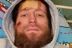 Боец с позывным «Иисус» в госпитале