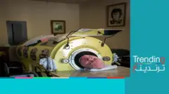 وفاة الرجل ذي الرئة الحديدية بعدما قضى 7 عقود داخل هيكل معدني