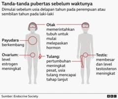 Ilustrasi grafis tubuh laki-laki dan perempuan yang memberi label tanda-tanda pubertas prekoks pada anak-anak.