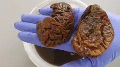 Dos hemisferios cerebrales antiguos