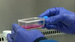 red blood cells