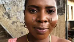 A woman with scars on her face
