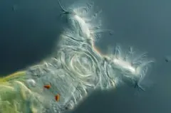 Imagem do rotífero bdeloídeo na água