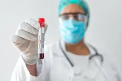 Monkeypox outbreak 2022 deaths: Brazil and Spain record first death from virus