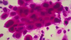 မှိုအဆိပ်ကြောင့် လတ်တလော အဆိပ်အတောက်ဖြစ်နိုင်တာ၊ ကိုယ်ခံအားနည်းစေတာ၊ မွေးရာပါရောဂါ တွေဖြစ်တာ၊ သန္ဓေသားကို ထိခိုက်နိုင်တာတွေအပြင် အဓိကတော့ အသည်းကင်ဆာကို ဖြစ်စေတယ်လို့ စစ်ဆေးတွေ့ရှိအတည်ပြုထား