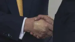 நீண்டகால இரத்தநாள பாதிப்பு, அமெரிக்கா, டிரம்ப் 