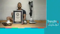 مصري يحقق رقما قياسيا بعد خسارة ساقه بهجوم قرش