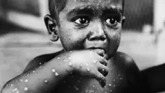 ከሰው ልጅ ምርጥ ስኬቶች መካከል ክትባት አንዱ ሊሆን ይችላል?