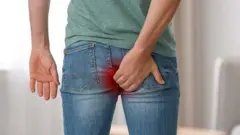 ፌስቱላ ደቂ ተባዕትዮ