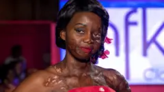 Flavia Naampima muathiriwa wa shambulio la Tindikali anasema mtizamo wa maisha yake umebadilika baada ya shambulio dhidi yake