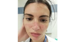 "ډاډمنه نه یم چې د نرسې په توګه به دندې ته دوام ورکړم او که نه"