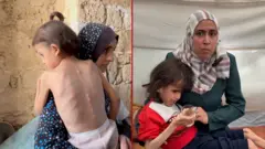 أطفال غزة يتضورون جواً تحت الحصار الإسرائيلي