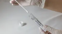 Cotonete e tubo com rótulo 'Covid-19' usados em teste PCR