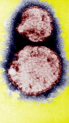 Gịnị bụ nje 'hantavirus' na-ewu ebe niile ugbua?