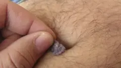 નાભિનો મેલ