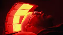 Fototerapia