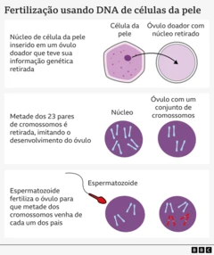Gráfico explicando os diferentes estágios de fertilização usando células da pele. Ele mostra o núcleo da célula da pele sendo colocado no interior de um óvulo doador que teve suas informações genéticas retiradas. Em seguida, aparece um núcleo púrpura com metade dos seus 23 pares de cromossomos retirados para imitar o desenvolvimento de um óvulo normal. Por fim, é exibido o espermatozoide fertilizando o óvulo para acrescentar seus cromossomos, de forma que metade deles venha de cada um dos pais.