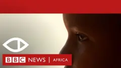 Africa eye