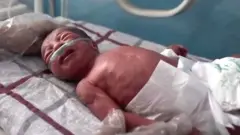 Borba novorođenčadi za život u Avganistanu
