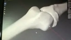 Upasuaji