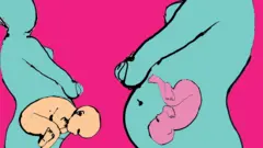 Pregnant women