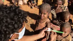 Retoboha, 4, obtendo medições de MUAC feitas por funcionários do PMA em Ambovombe, um dos distritos com um número muito alto de crianças desnutridas.