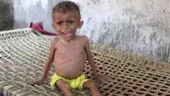 ગ્લોબલ હંગર ઇન્ડૅક્સ