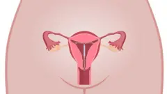diagram showing coil in the womb