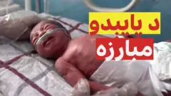 سیمه ییز ډاکټران وايي واک ته د طالبانو له یو کال پوره کېدو وروسته، بدخشان ولایت کې د نوزیږو ماشومانو مړینه او د ماشوم ضایع کېدو پېښې نژدې دوه برابره شوې دي.