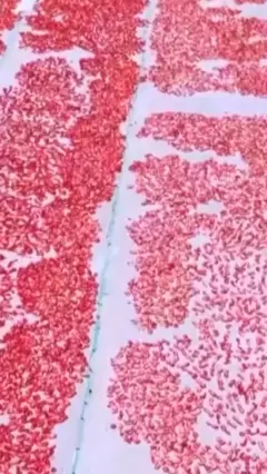 தக்காளிகள்