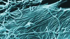 Ebola